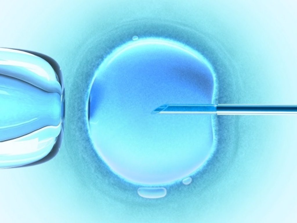 Ovodonacion La Tecnica De Fertilidad Con Mejores Resultados