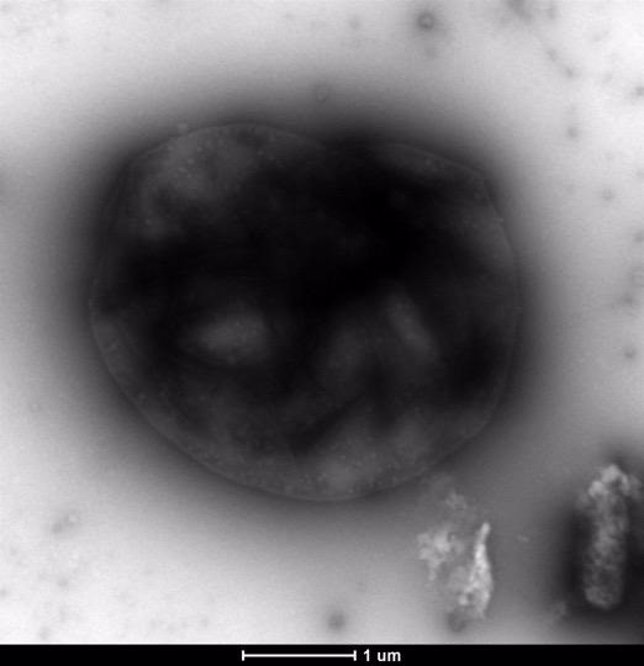 Muestra de bacteria que captura metano