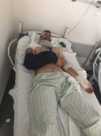 Un ciclista de Bolaños, ingresado tras ser atropellado por un camión que se dio a la fuga