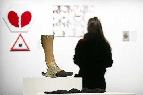 A prosthetic knee is displayed at the Museum of Broken Relationships installed a