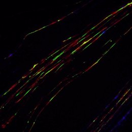 Fibras de ADN marcadas con sondas fluorescentes
