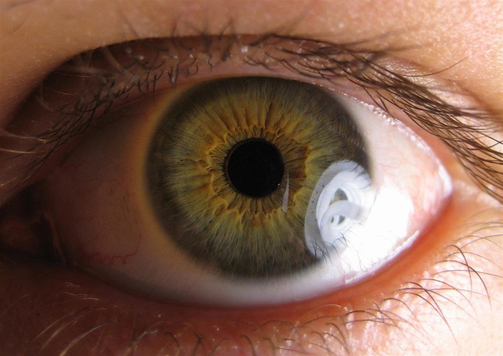 El Ibuprofeno Sube La Tension Ocular