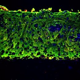Piel en 3D de células madre para tratar defecto de espina dorsal