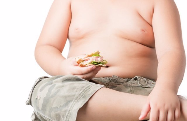 Obesidad infantil. Niño con sobrepeso