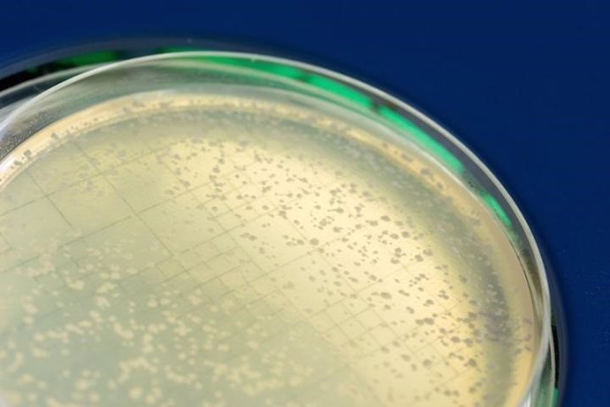 Placa de Petri con colonias de levadura, hongos