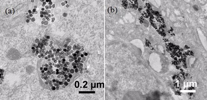 Nanopartículas internalizadas en células cancerosas 