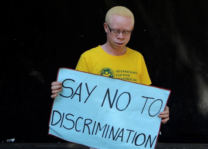 Un albino con una pancarta contra la discriminación en Harare