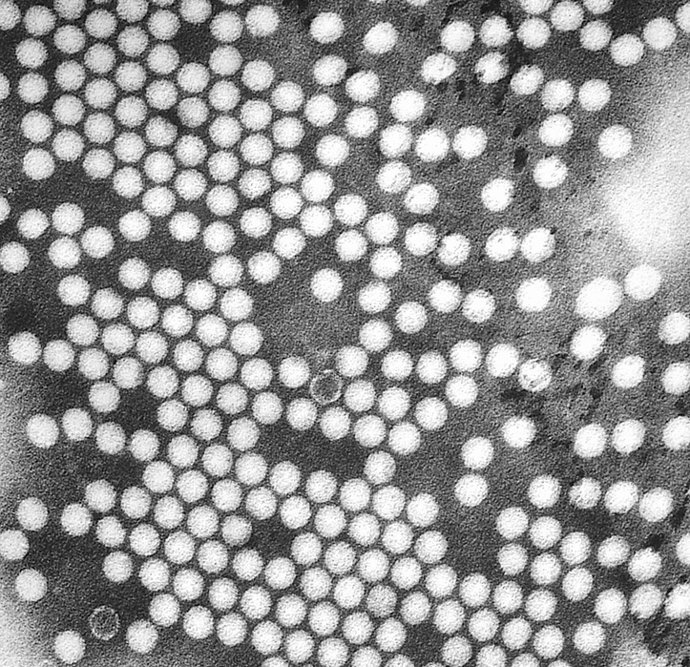 Virus de la pòlio 
