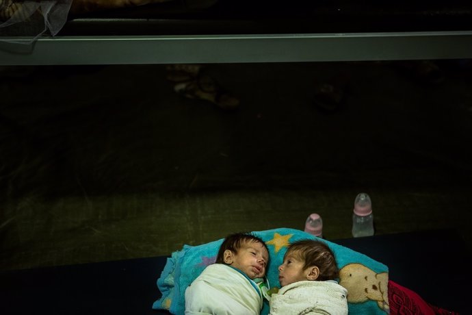Dos gemelos desnutridos tratados en una clínica de MSF cerca de Mosul