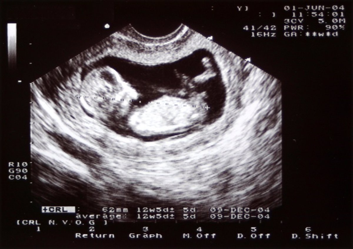 El diario de un feto, 9 meses desde dentro