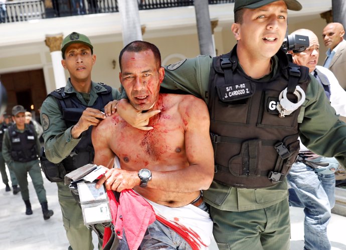 An injured government supporter is taken away by security forces after he and a 