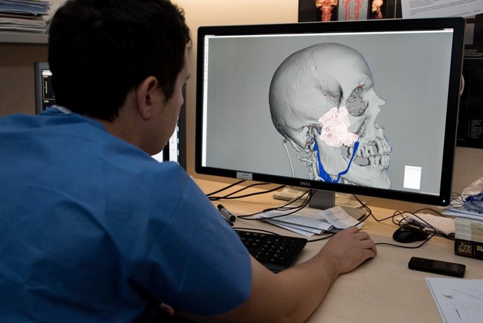 Impressió 3D per planificar intervencions a l'Hospital Clínic