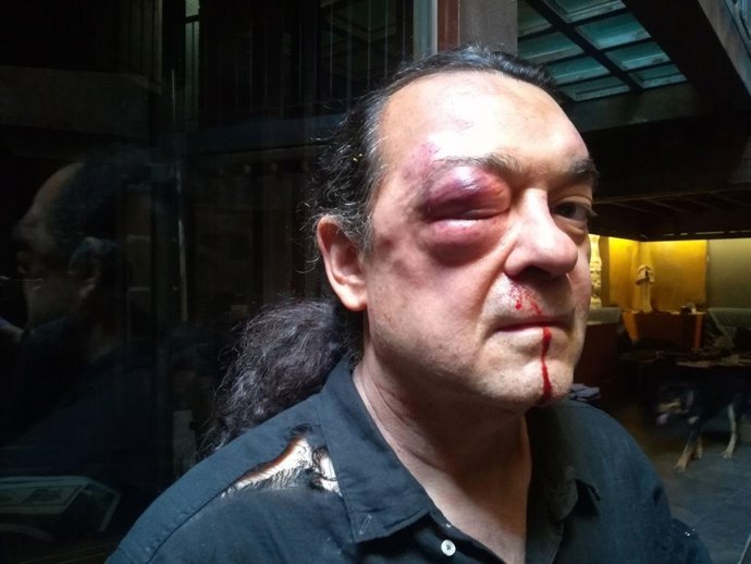 Agressió Barredo