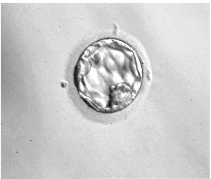 Embrión día 5