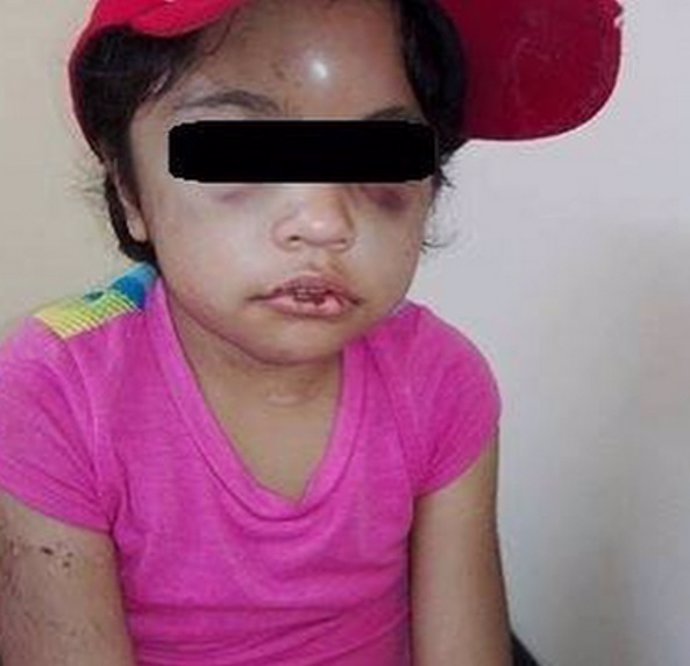 Niña de siete años golpeada en México