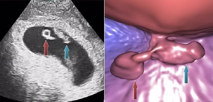 Investigadores desarrollan técnica ecografías virtuales embrios implantados