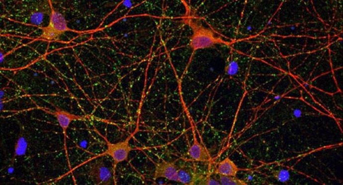 Imágenes de microscopía de cultivos de células neuronales