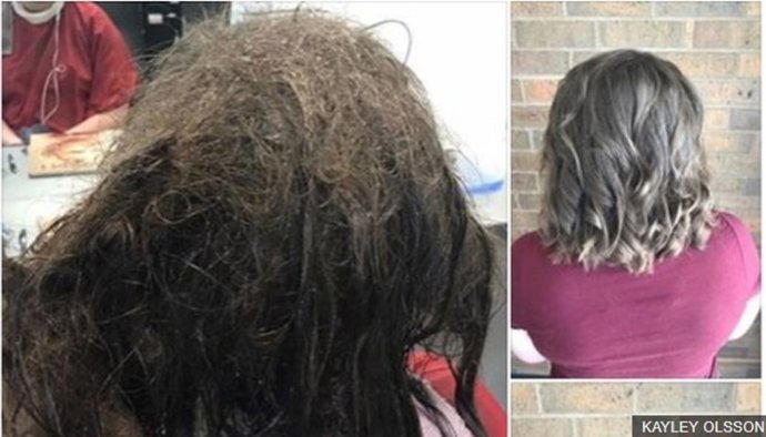 Adolescente con depresión severa