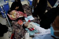 Los nuevos casos de cólera en Yemen caen un tercio gracias a "héroes anónimos", según UNICEF
