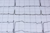 Foto: Electrocardiogramas en la ESO para prevenir la muerte súbita