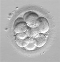 Nace por selección embrionaria la primera niña en España sin BRCA1