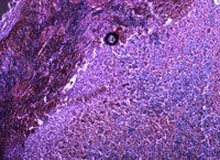 Descubren una biomolécula que ayuda al sistema inmune a superar el cáncer