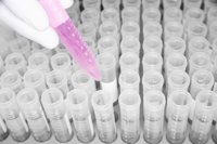 Hospital Virgen de las Nieves de Granada analiza microorganismos bacterianos y su relación con el infarto de miocardio