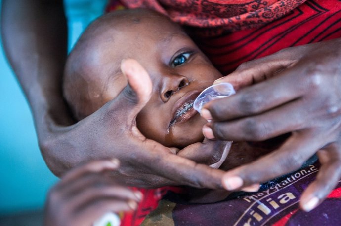 Niño con desnutrición en Kenia