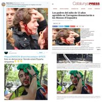 Referendum Cataluña: Las fotos de falsos heridos que circulan por las redes