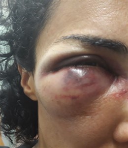 Una dona ferida en una càrrega en l'Escola Mediterrània de Barcelona l'1-O