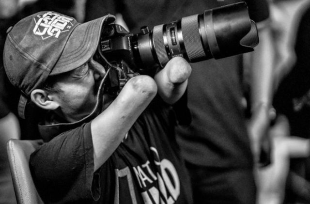Fotógrafo indonesio Achmad sin extremidades