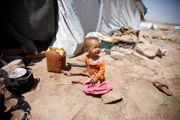 Niño afectado por el conflicto en Yemen