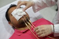 Impresoras 3D para proteger a la piel sana del tratamiento del cáncer