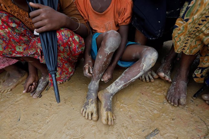 Refugiados rohingya en Bangladesh 