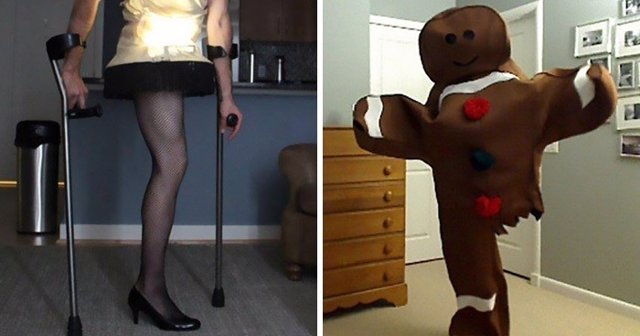Superviviente de cáncer sin una pierna se disfraza cada Halloween 
