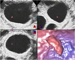 Foliculoscopia virtual