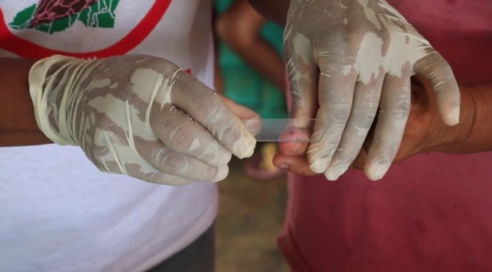 Tres paises iberoamericanos premiados por su lucha contra la malaria