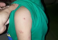 Sindicato lamenta la plaga de parásitos que "asola" al alumnado del colegio 'Puerta del Mar' de Algeciras (Cádiz)