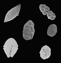 Microalgas para combatir el cáncer de próstata y mama