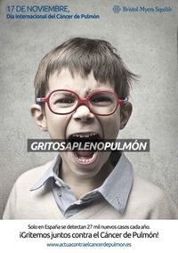 Lanzan la campaña 'GritosAPlenoPulmón' para dar voz a las 27.000 personas que cada año padecen cáncer de pulmón 