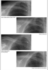 Fundación Raíces denuncia la "completa indefensión" de los niños extranjeros que están solos en España