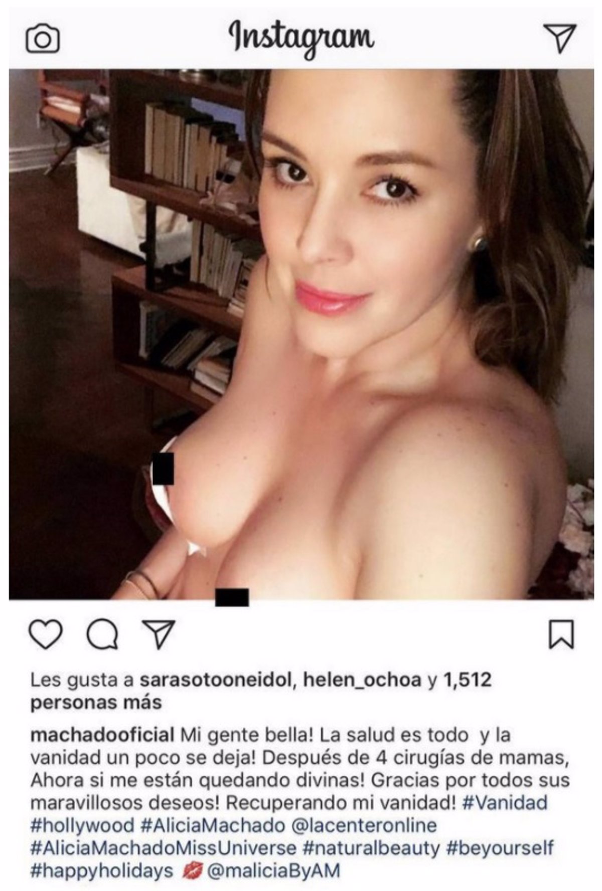 La ex Miss Universo Alicia Machado muestra sus pechos después de una  reconstrucción mamaria