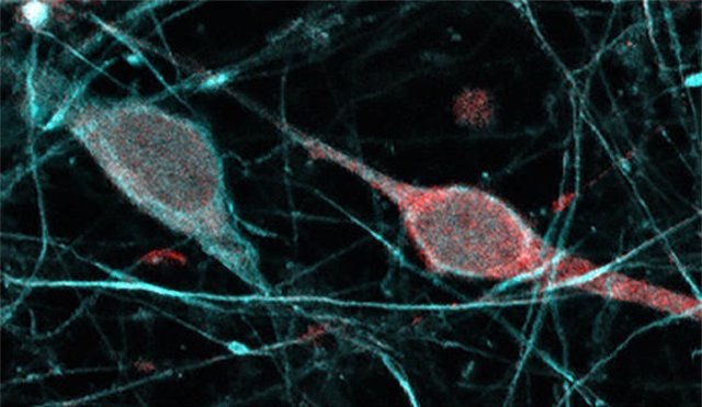 Neuronas con expresión de enzimas productoras de dopamina en el neocortex humano