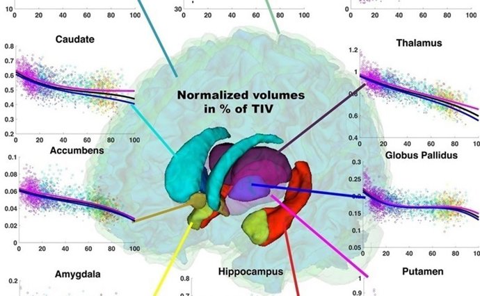 Estudio sobre el cerebro 