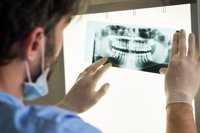 Casi el 40% de los mayores de 55 años lleva implantes dentales