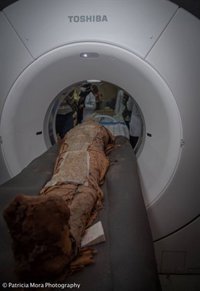 Un TAC realizado a cuatro momias egipcias permite identificar el caso más antiguo de cáncer de mama