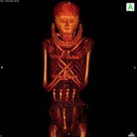 El Proyecto Qubbet el-Hawa de la UJA constata diversos métodos de momificación gracias a TAC realizados a momias