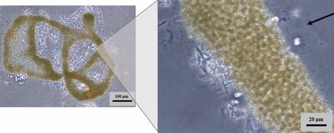 Colonia formada por células de la cianobacteria Microcystis aeruginosa