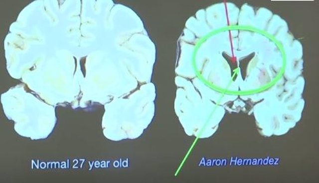 cerebro comparación