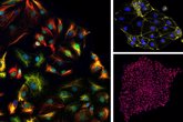 Foto: Investigadores de la UMA obtiene células epicárdicas 'in vitro' a partir de células madre humanas